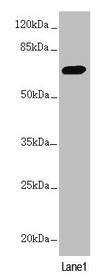 Anti-PPP2R3B Antibody