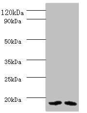 Anti-PAM16 Antibody