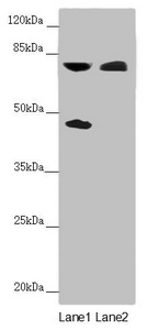 Anti-CEP83 Antibody