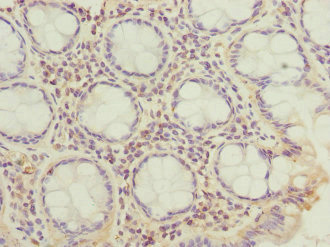 Anti-CFAP20 Antibody