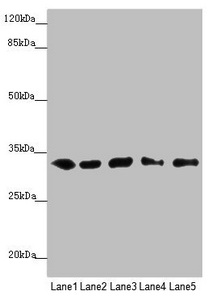 Anti-MMACHC Antibody