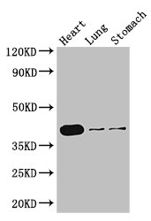 Anti-DMRT1 Antibody