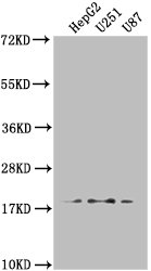 Anti-ARL2BP Antibody