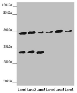 Anti-BCS1L Antibody