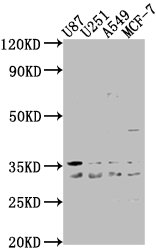 Anti-ATP6V1D Antibody