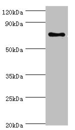 Anti-SLC27A6 Antibody