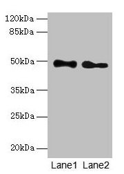 Anti-ABHD2 Antibody