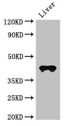 Anti-CCR3 / CD193 Antibody