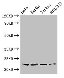 Anti-RPS5 Antibody