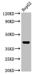 Anti-FDPS / Farnesyl pyrophosphate synthase Antibody