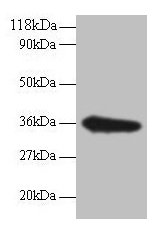 Anti-TSTA3 Antibody