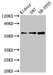 Anti-KCNAB1 Antibody