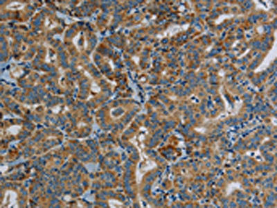 Anti-PPARGC1B Antibody