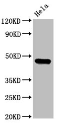 Anti-CSNK1E Antibody