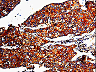 Anti-MMP3 Antibody