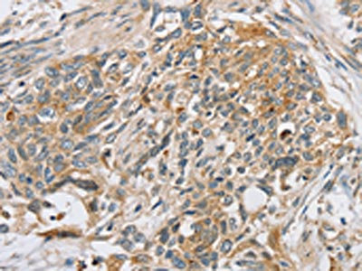 Anti-SLC5A6 Antibody