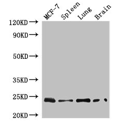 Anti-RAB25 Antibody