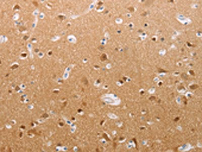 Anti-PFN2 Antibody