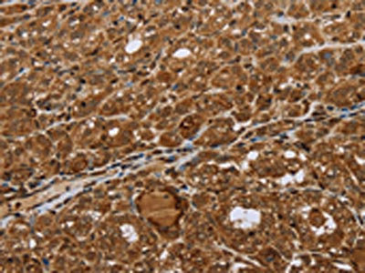 Anti-STMN2/STMN3/STMN4 Antibody