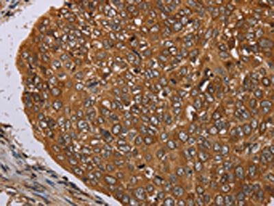 Anti-PIM3 Antibody