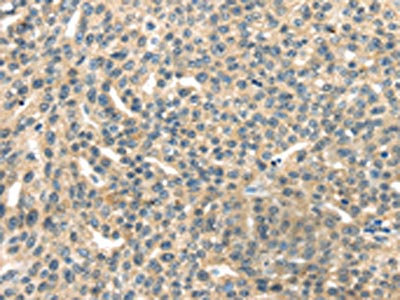 Anti-RASA2 Antibody