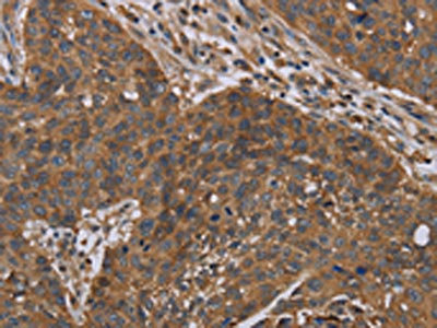 Anti-OXTR Antibody