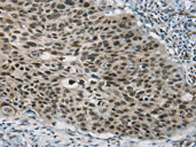 Anti-SART3 Antibody
