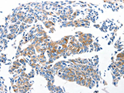 Anti-Ccl6 Antibody