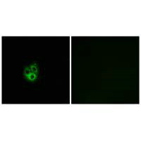Anti-GNG5 Antibody
