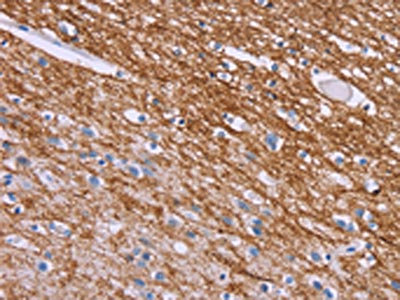 Anti-CRH Antibody