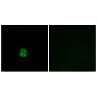 Anti-CHST6 Antibody