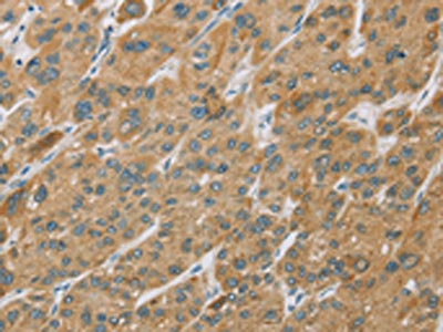 Anti-CYP27A1 / Sterol 26-hydroxylase mitochondrial Antibody