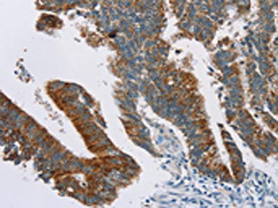Anti-RPS6KA2 Antibody