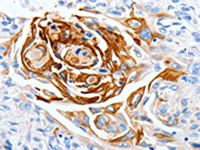 Anti-LPAR4 Antibody
