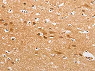 Anti-CDH6 / K-Cadherin Antibody