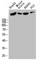 Anti-RYR2 Antibody