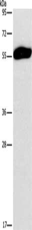 Anti-SPAG6 Antibody