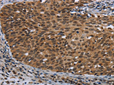 Anti-CEBPD Antibody