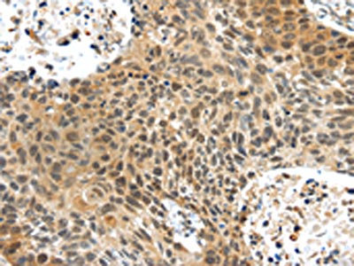 Anti-PLIN3 Antibody