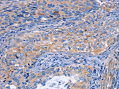 Anti-MATN3 / Matrilin 3 Antibody