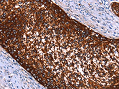 Anti-HMGCS2 / Hydroxymethylglutaryl-CoA synthase mitochondrial Antibody