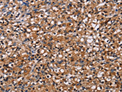 Anti-NPM3 Antibody