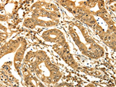 Anti-RAB26 Antibody