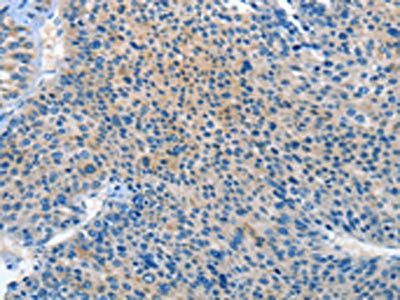 Anti-PRKX Antibody