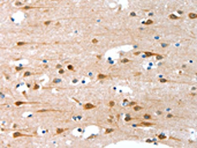 Anti-ALS2CR11 / C2 calcium-dependent domain-containing protein 6 Antibody