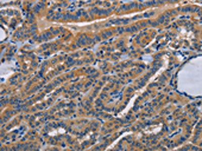 Anti-STRADB / STE20 related kinase adapter protein beta Antibody