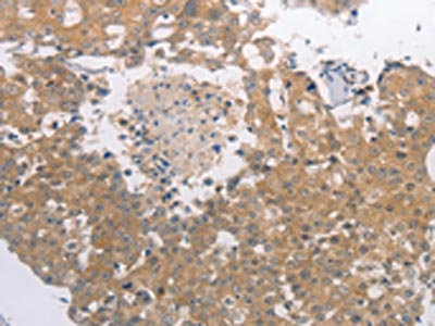 Anti-PGA3/4/5 Antibody