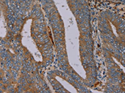 Anti-PYY Antibody