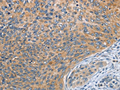 Anti-SPIRE2 Antibody