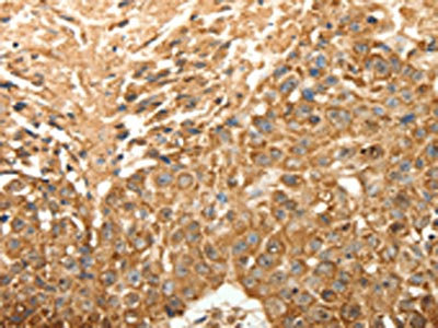 Anti-SLC25A11 Antibody